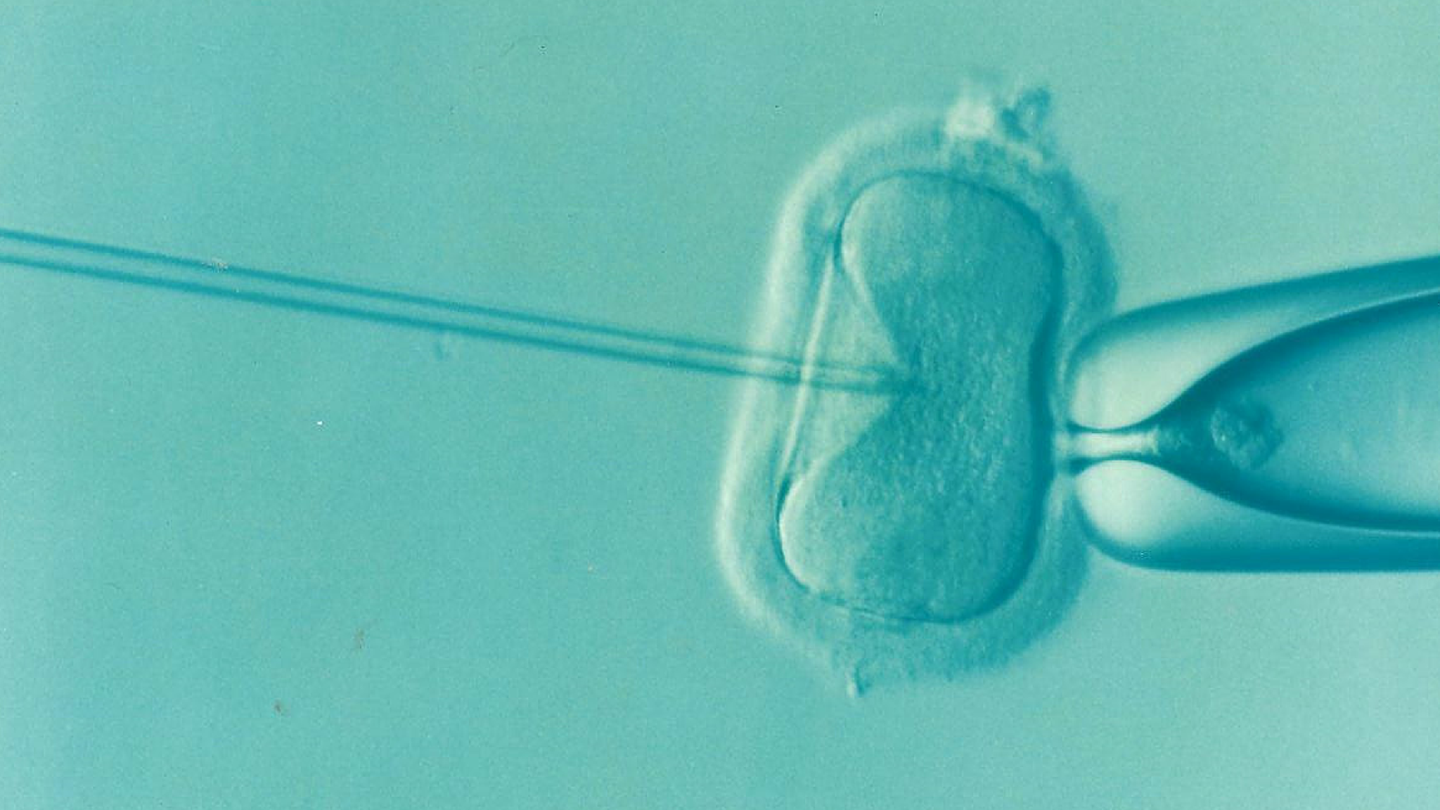 Lees meer over het artikel De nachtmerrie van IVF