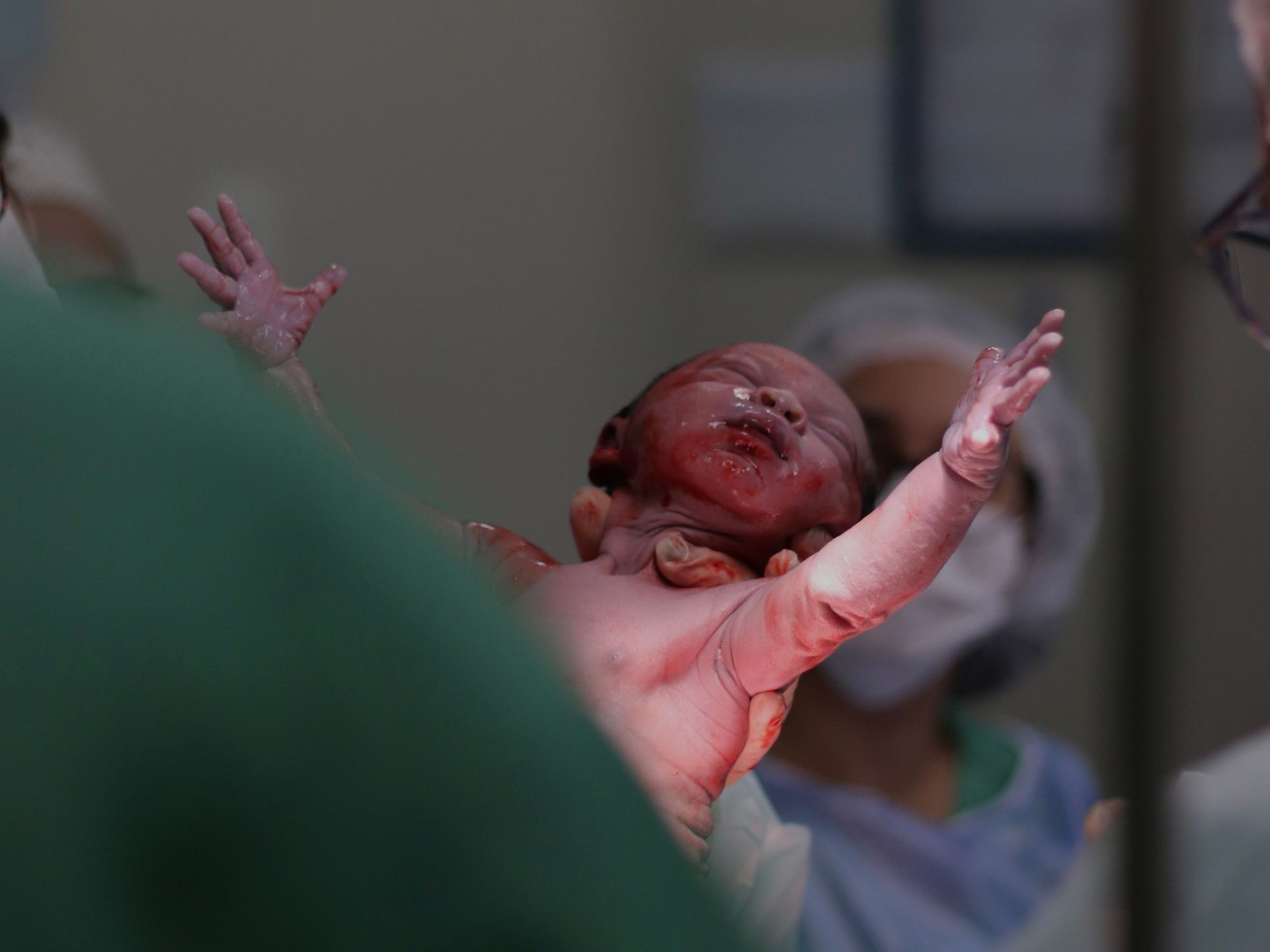 Lees meer over het artikel Nederland: proef met abortus in week 22 tot 24